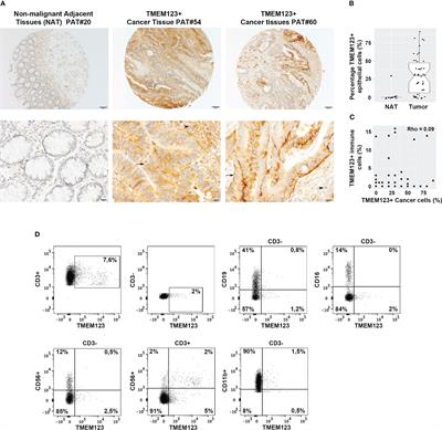 TMEM123 a key player in immune surveillance of colorectal cancer